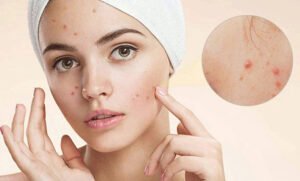 du thua axit trong co the ion life 6 Sức khỏe và Đời sống